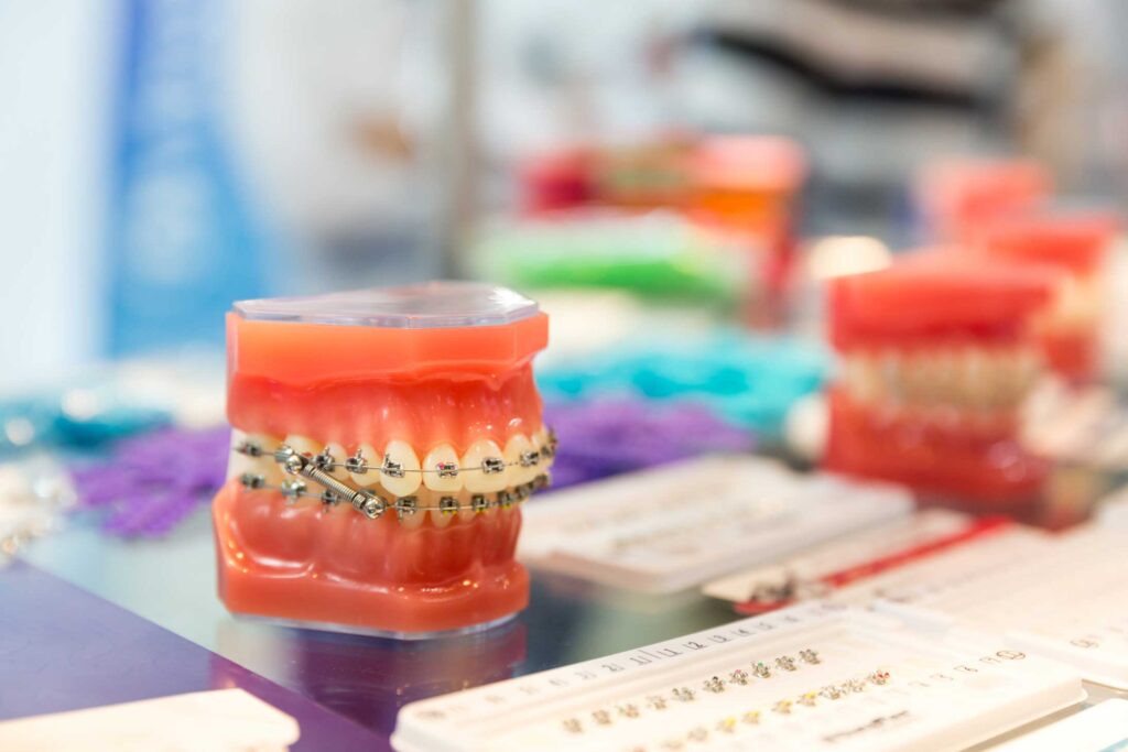 tratamientos-ortodoncia-optima-dental