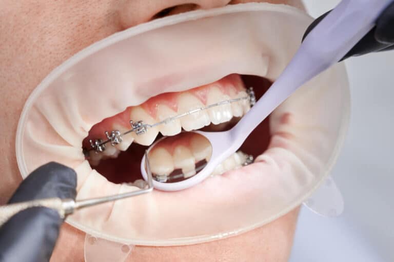 tratamientos de ortodoncia en Madrid