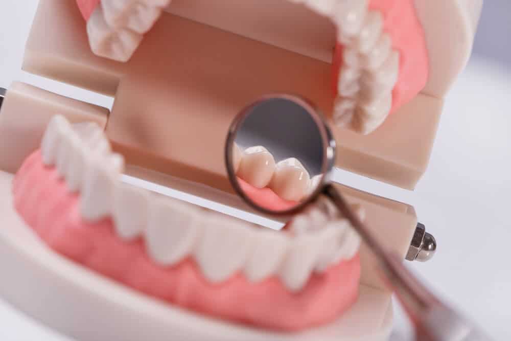 tipos de prótesis dentales Madrid